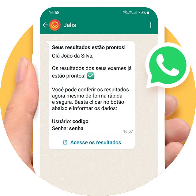 Notificação de resultados prontos por WhatsApp e e-mail